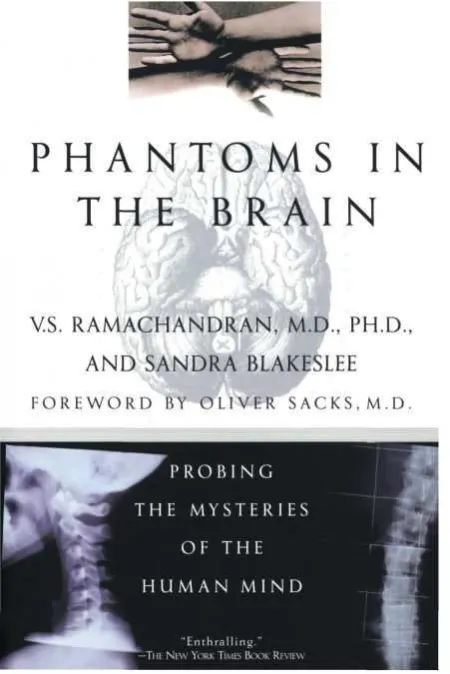 Phantoms In The Brain