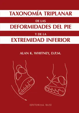 Taxonomía Triplanar de las Deformidades del Pie