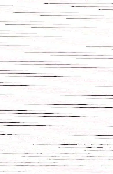 Trastorno por Déficit de Atención con Hiperactividad