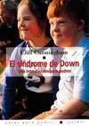 El Síndrome de Down