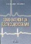 CÓMO ENTENDER UN ELECTROCARDIOGRAMA