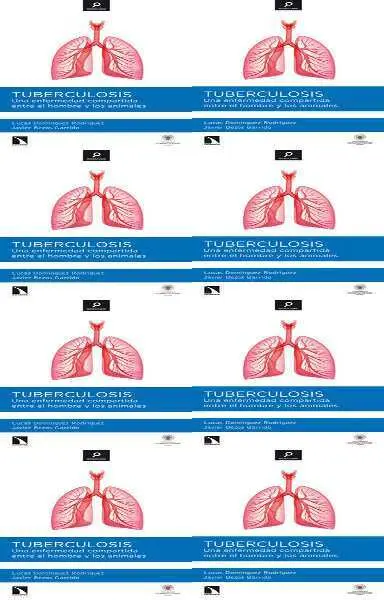 Tuberculosis