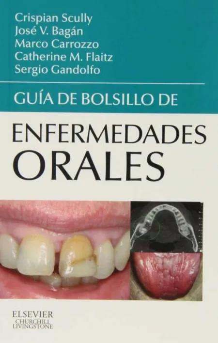 Guía de Bolsillo de Enfermedades Orales