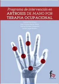 Programa de Intervención Em Artrosis de Manos por Terapia Ocupacional