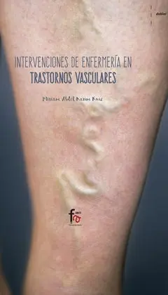 Intervenciones de Enfermería en Trastornos Vasculares