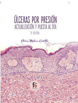 ULCERAS POR PRESION.-3 EDICION