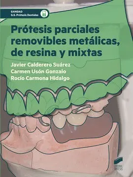 Prótesis Parciales Removibles Metálicas, de Resina y Mixtas