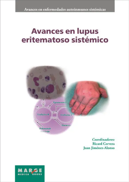 Avances en Lupus Eritematoso Sistémico