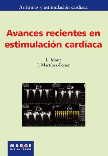 Avances Recientes en Estimulación Cardíaca