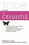 Todo Sobre la Celulitis
