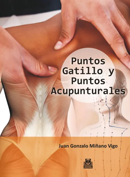 Puntos Gatillo y Puntos Acupunturales (Color)