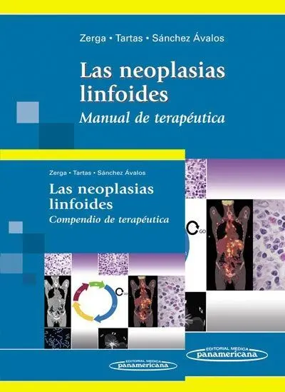 Neoplasias Linfoides, la (2 Volúmenes)