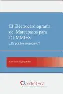 El Electrocardiograma del Marcapasos para Dummies. Es Posible Entenderlo?