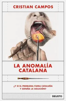 La Anomalía Catalana