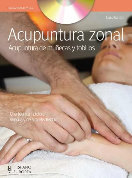Acupuntura Zonal (+Dvd)