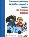 Implantes Cocleares para Niños Pequeños Sordos