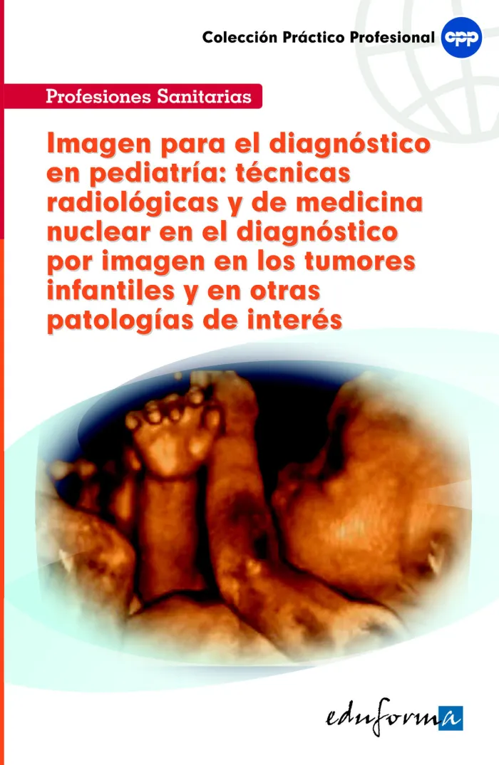 Imagen para el Diagnóstico en Pediatría: Técnicas Radiológicas y de Medicina Nuclear en el Diagnóstico por Imagen en los Tumores
