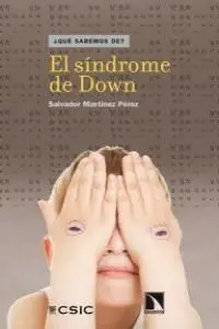 El Síndrome de Down