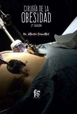 Cirugía de la Obesidad 2ªed
