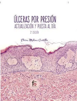 Ulceras por Presion. -3 Edicion