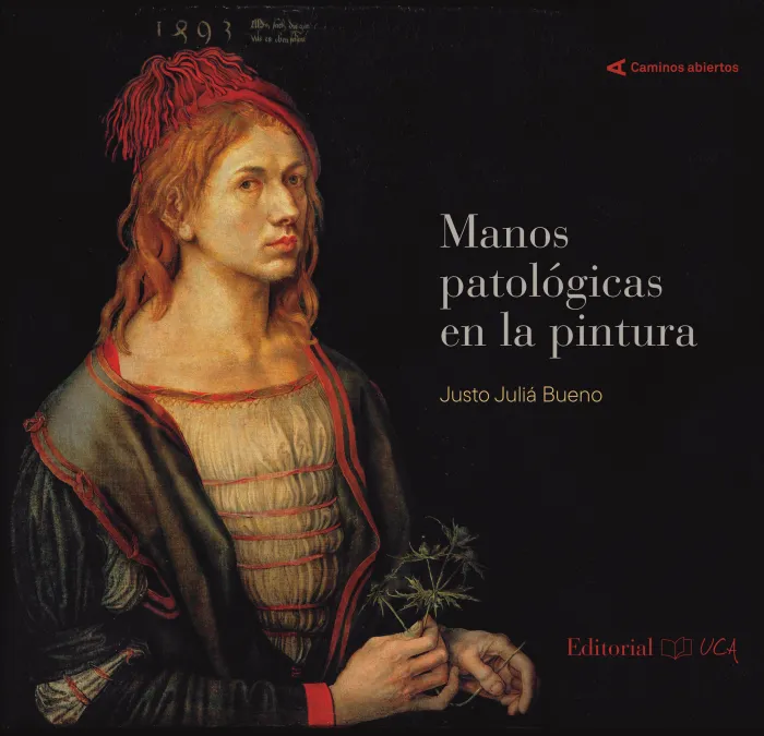 Manos Patológicas en la Pintura
